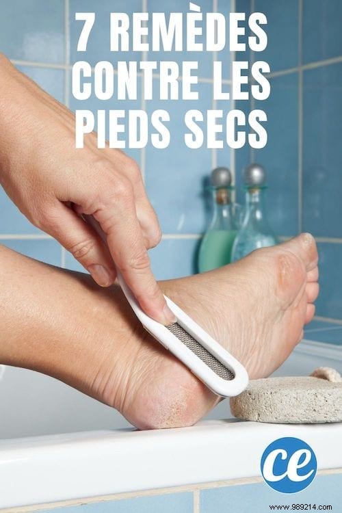 Dry feet? 7 Magical Remedies For SOFT Feet! 