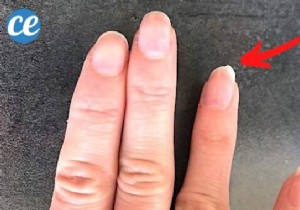 Brittle nails? The Miracle Remedy For UNBREAKABLE Nails! 