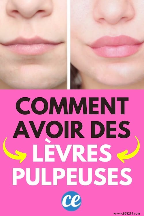 How To Get Fuller Lips Naturally? 12 Tricks That Work. 