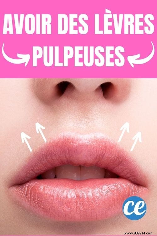 How To Get Fuller Lips Naturally? 12 Tricks That Work. 