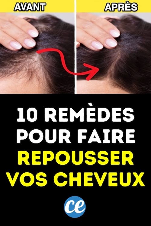 10 Natural And Effective Remedies To Regrow Your Hair. 