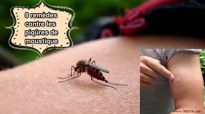 8 Home Remedies For Itchy Mosquito Bites. 