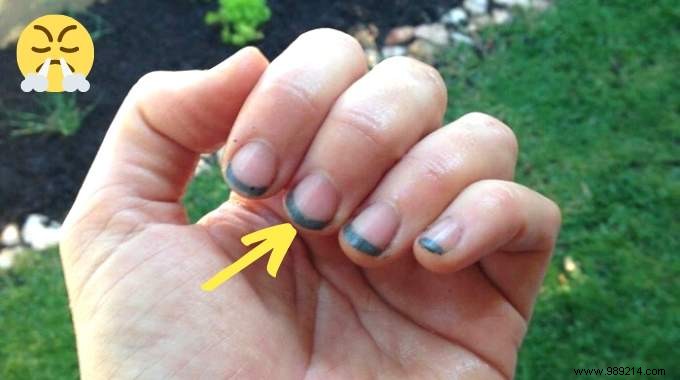 Gardening:THE Genius Trick to Never Have BLACK NAILS Again. 