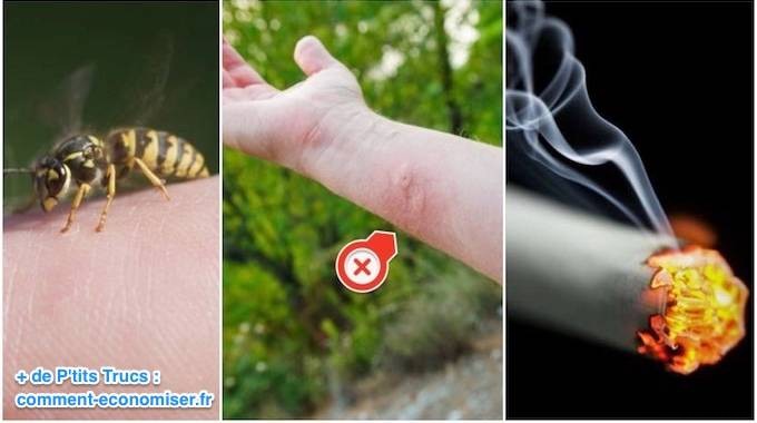 How to quickly relieve a wasp sting with a cigarette. 