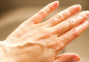 The Amazing Trick to Soften Your Hands Naturally in 2 Min. 