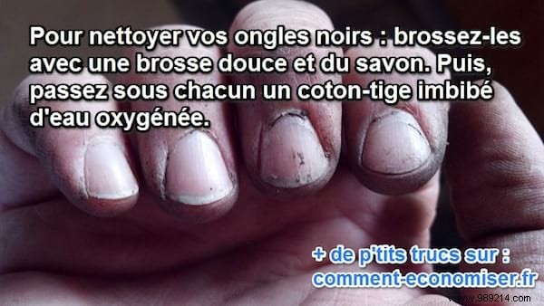 Do You Have Dirty Black Nails? Here is the Tip To Clean Them Easily. 