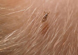 4 Teacher Tips for Fighting Lice. 