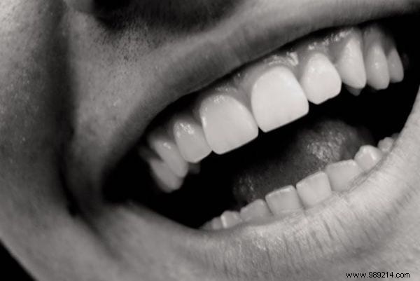 A Tip To Whiten Teeth:Effective and Natural. 