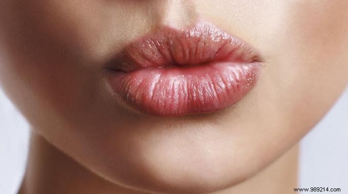 The 10 Most Amazing Natural Tips Against Chapped Lips. 