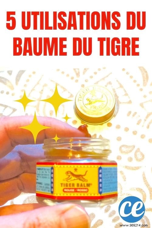 5 Tiger Balm Uses You Should Know About. 