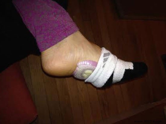 Here s What Happens When You Put Onions In Your Socks Overnight. 