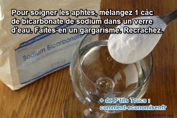 My Grandmother s Remedy for Canker Sores:Bicarbonate. 