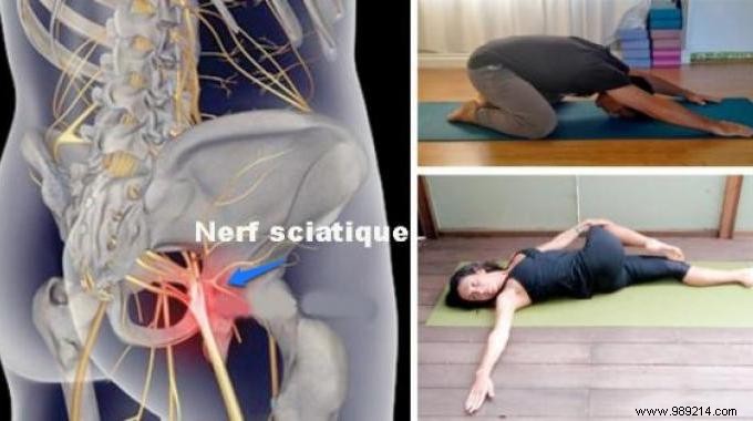 8 Positions To Relieve Sciatica Pain In Less Than 15 Min. 