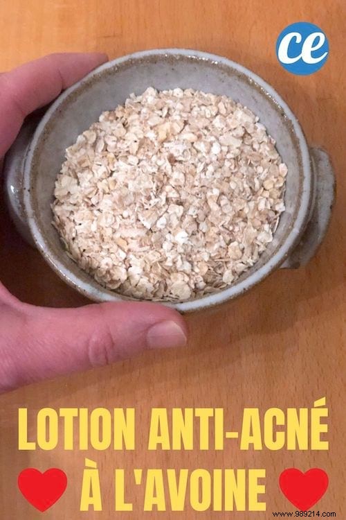 My 2 Natural Oatmeal Tips To Fight Acne. 