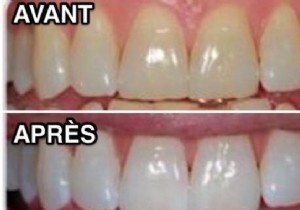 How To Get White Teeth IN NO TIME :-) 