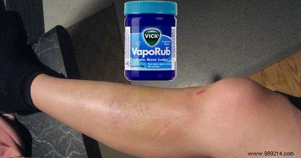 18 Magical Uses of VapoRub Everyone Should Know. 