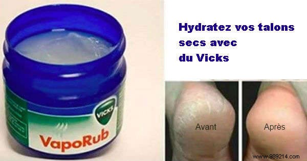 18 Magical Uses of VapoRub Everyone Should Know. 