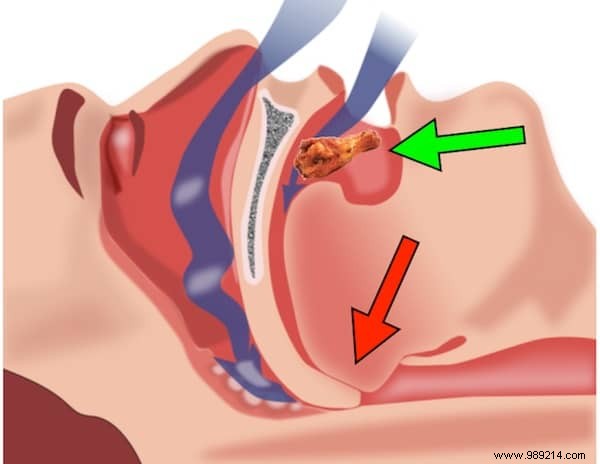 10 Effective Remedies To STOP Snoring Tonight. 