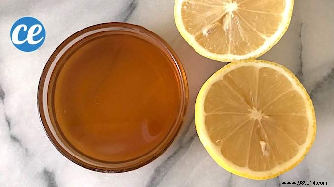 Gout Attack:Say Goodbye To Pain With This Miracle Remedy. 