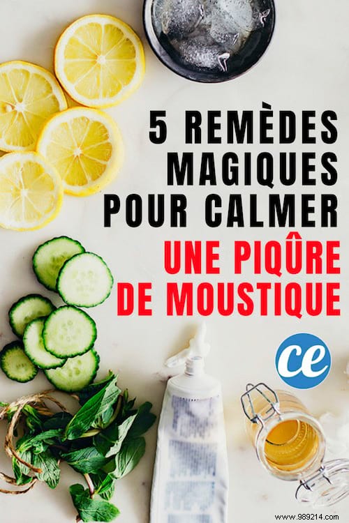 5 Magical Remedies To Calm A Mosquito Bite Instantly. 