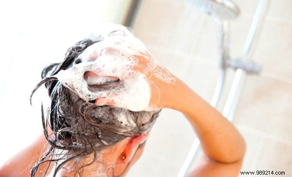 12 Ultra-Effective Remedies To Eliminate Dandruff Naturally. 