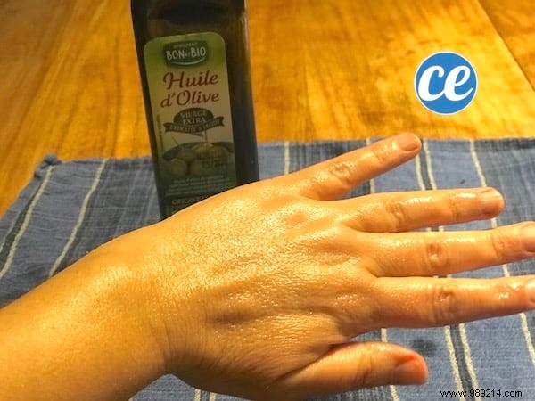 6 Grandma s Remedies To Say Goodbye To Dry, Damaged Hands. 