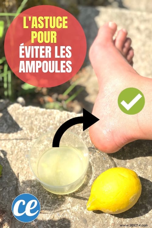 Blisters On Your Feet:THE Surprising Tip To Never Have Them Again! 