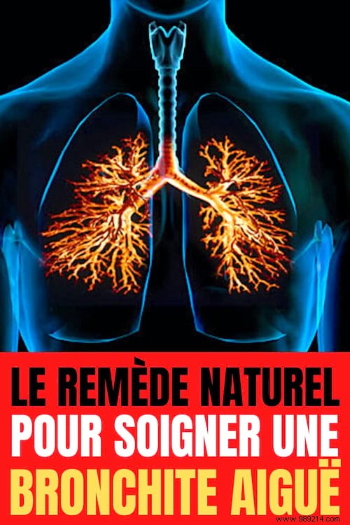 Acute Bronchitis:The Radical Remedy With Essential Oils. 