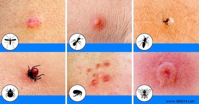 How do I know which insect has bitten me? The Easy Photo Guide. 