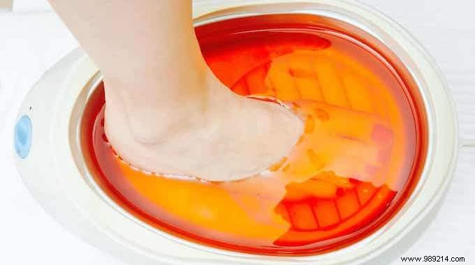 4 Super Vinegar Remedies for Varicose Veins, Corns and Calluses. 