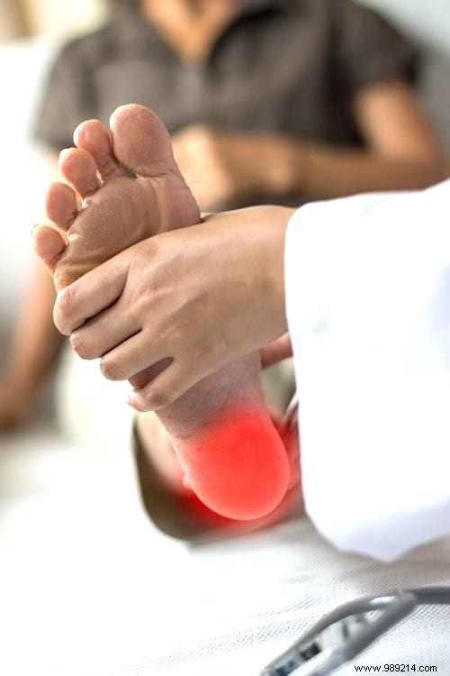 Plantar Fasciitis:6 Easy Exercises Against Foot Pain. 