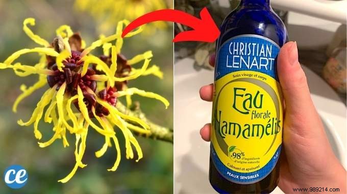 17 Benefits of HAMAMELIS WATER That Nobody Knows 