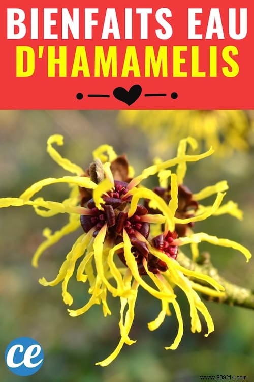 17 Benefits of HAMAMELIS WATER That Nobody Knows 