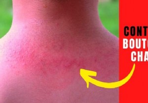 8 remedies that work to get rid of heat rash. 