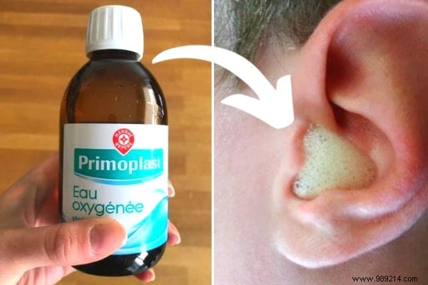 Forget Cotton Swabs! Here s How To Safely Clean Your Ears. 