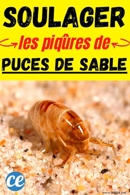 Sand Fleas:How to Relieve Bites INSTANTLY. 