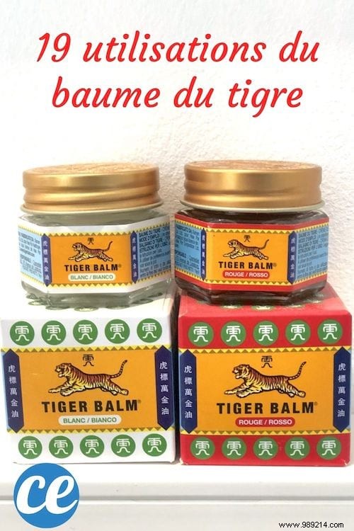 19 Tiger Balm Uses Nobody Knows About. 