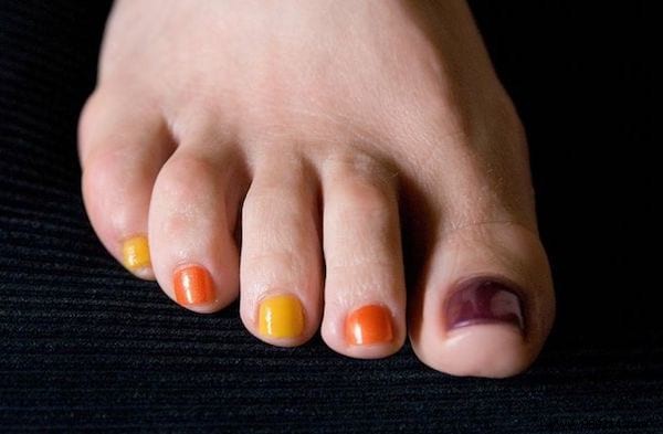 5 Homemade Pedicure Ideas For Sexy Feet! 