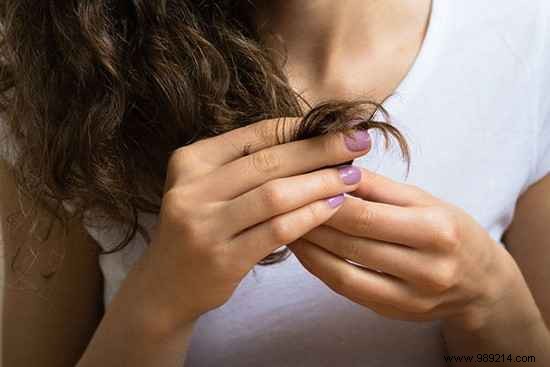 Castor Oil:6 Incredible Benefits For Hair And Skin. 