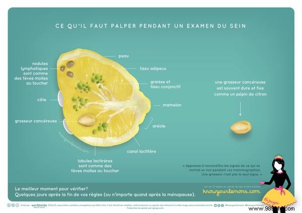 What Does Breast Cancer Look Like? Here is the photo that will help you detect it. 