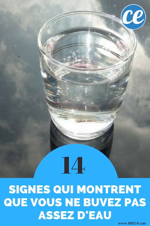 14 Signs That Show You re Not Drinking Enough Water (And How To Fix It). 