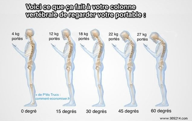 Here s What It Does To Your Spine To Look At Your Cellphone. 