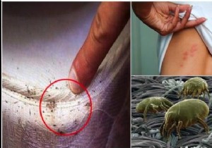 These critters live in your bed and attack your lungs! Here is the Easy, Fast and Natural Method To Eliminate Them. 