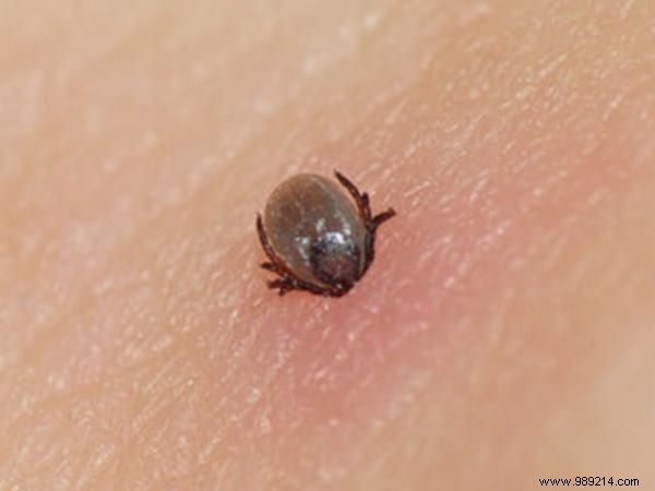 3 Essential Tips To Avoid Being Bitten By A Tick. 