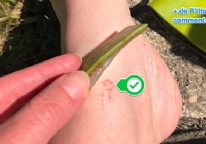 How To Heal A Wound In A Snap With Aloe Vera. 