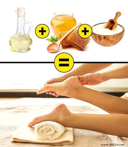 10 MIRACLE Remedies for Dry and Cracked Heels. 