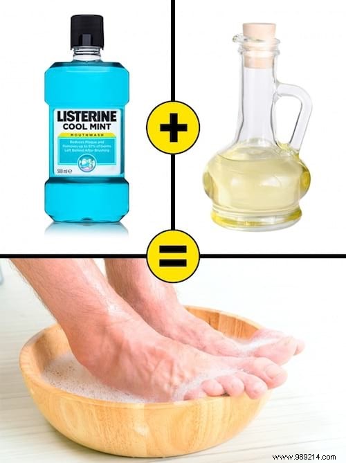 10 MIRACLE Remedies for Dry and Cracked Heels. 