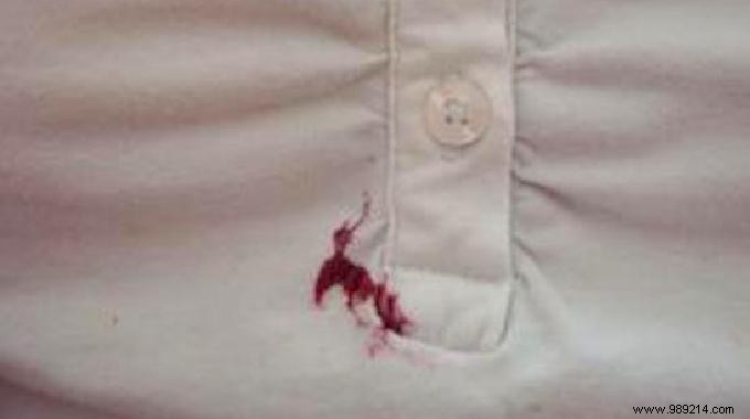 The Miracle Trick to Make a Jam Stain Disappear. 