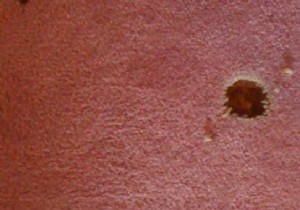 Burnt carpet? The Simple Trick To Fix It. 