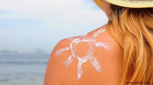 15 Natural Remedies To Relieve A Sunburn WITHOUT Biafine. 